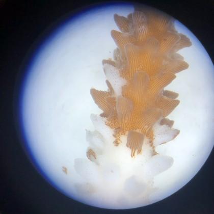 Coral microscopy, tissue loss