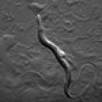 Roundworm