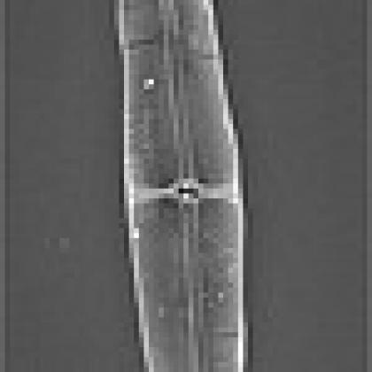 Diatoms