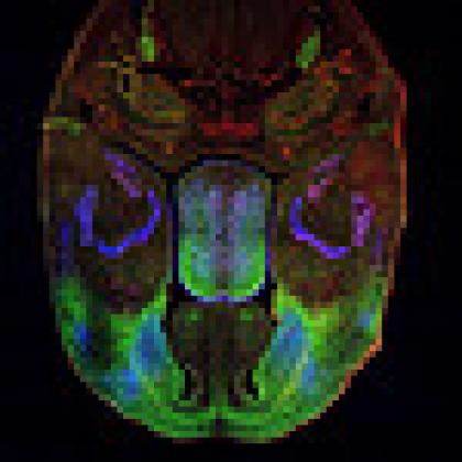Embryonic brain of a mouse