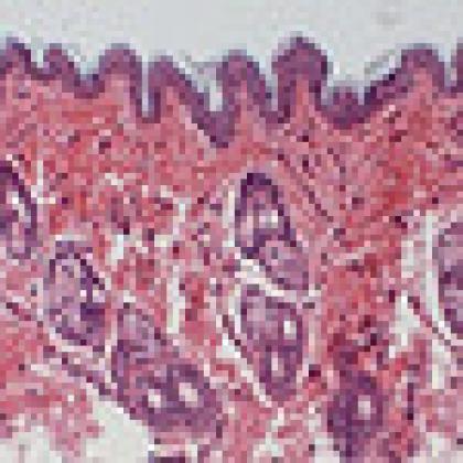 Normal skin