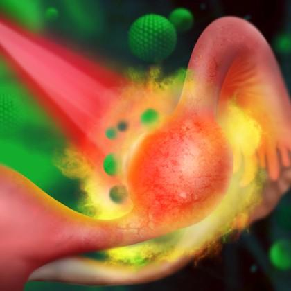 Graphic: Nanomedicine for treating ectopic pregnancy (credit: Parinaz Ghanbari)