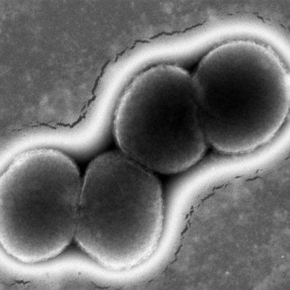 Neisseria gonorrhoeae